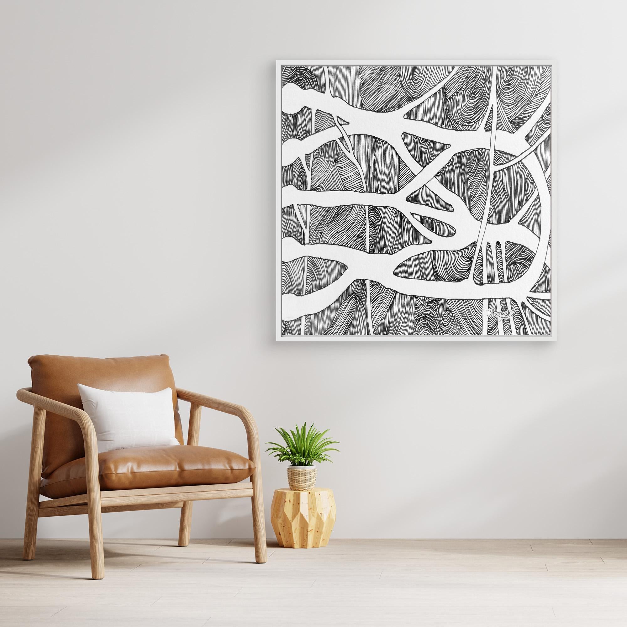 Brachial root plexus