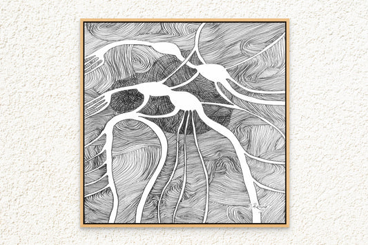 Canvas Print: Vagus Nerve Plexus