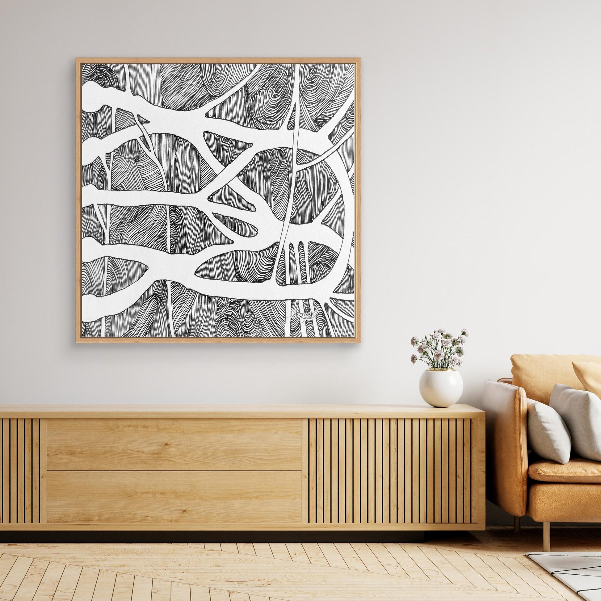 Brachial root plexus