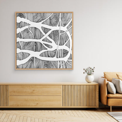 Brachial root plexus