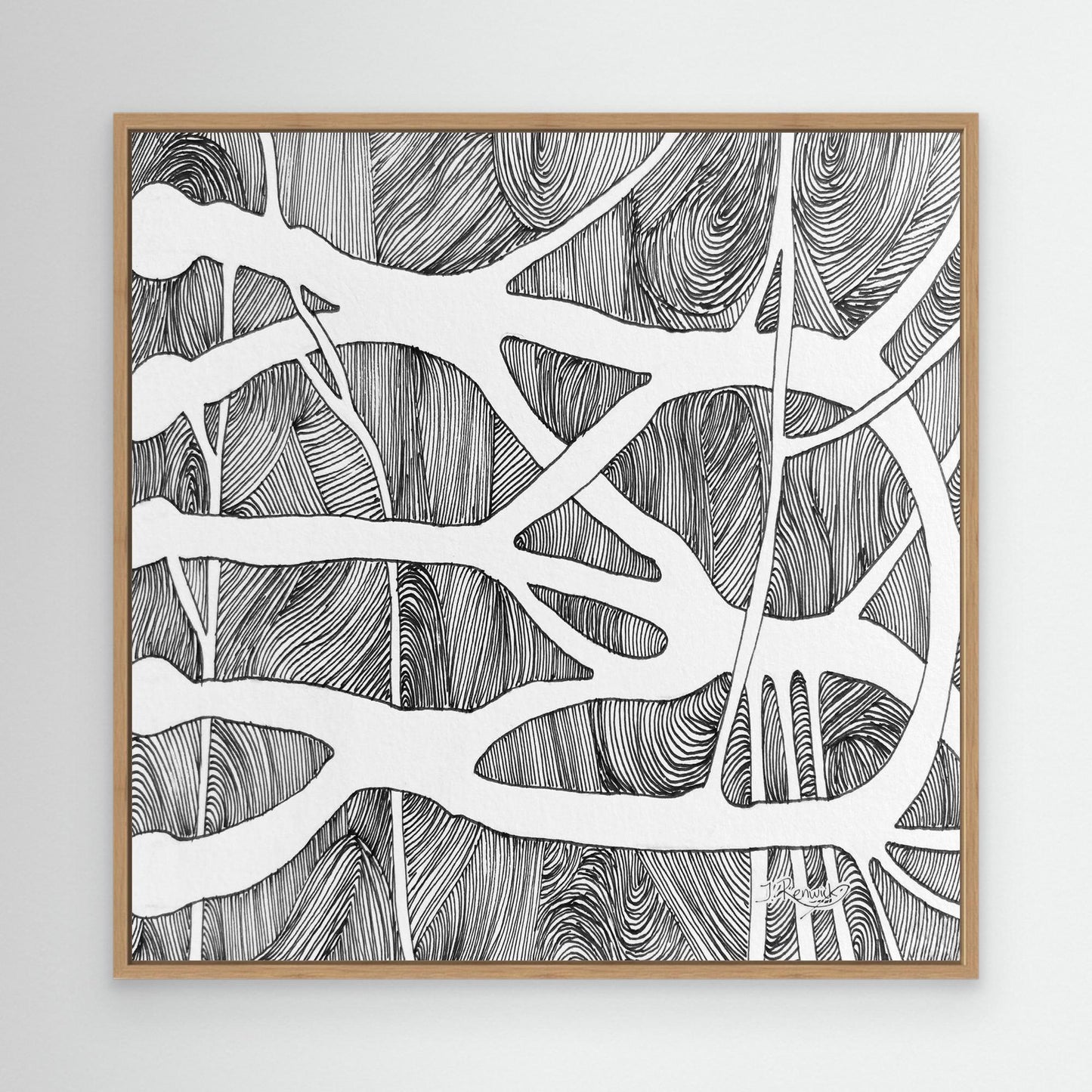 Brachial root plexus