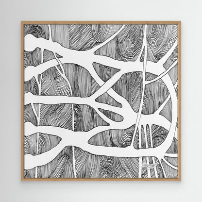 Brachial root plexus