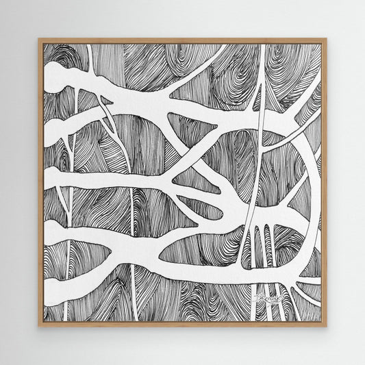 Brachial root plexus