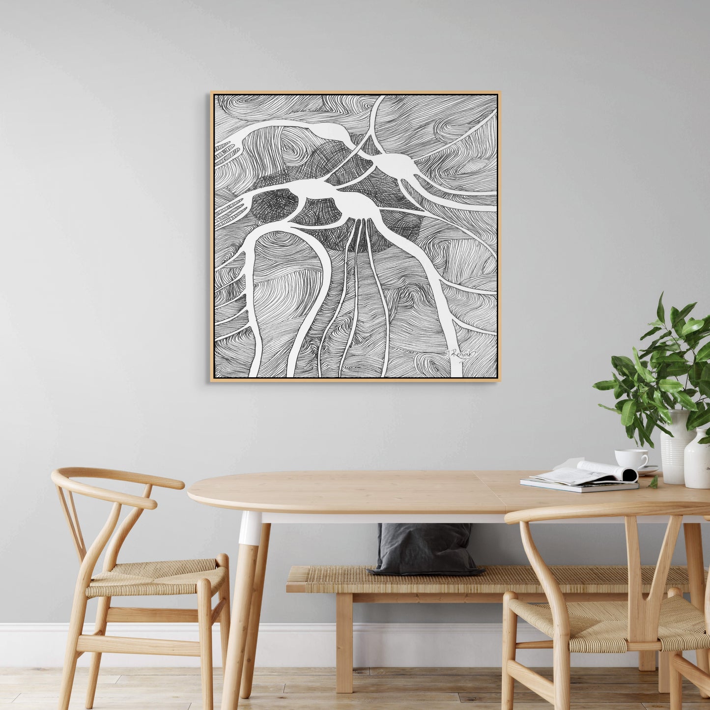 Canvas Print: Vagus Nerve Plexus