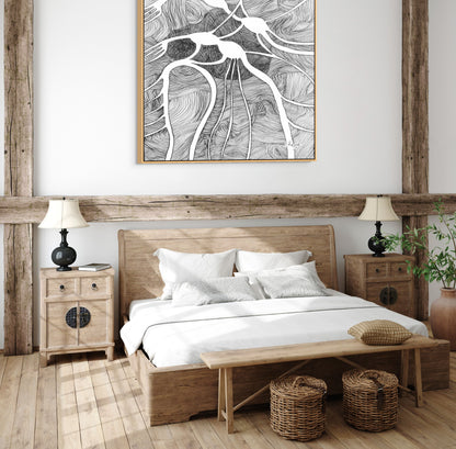 Canvas Print: Vagus Nerve Plexus