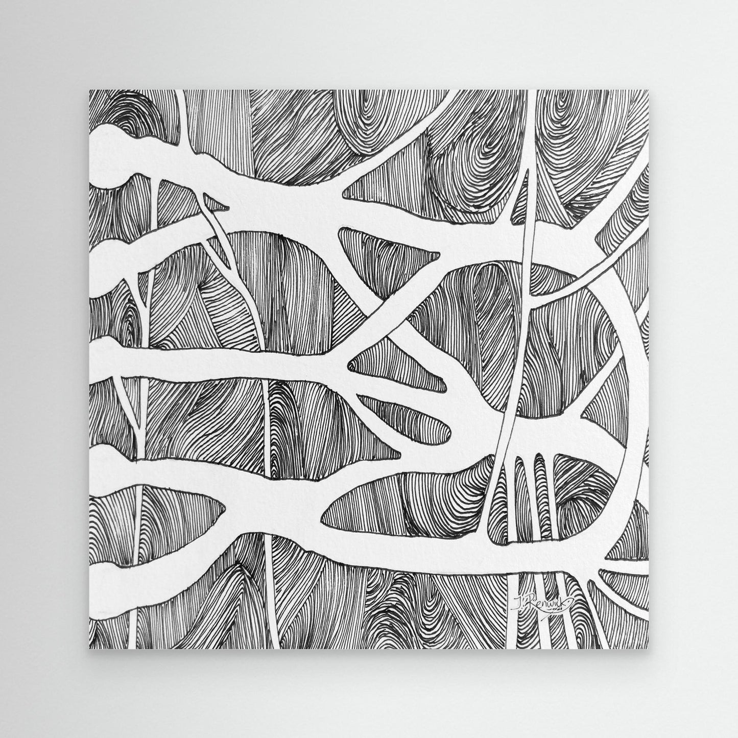 Brachial root plexus