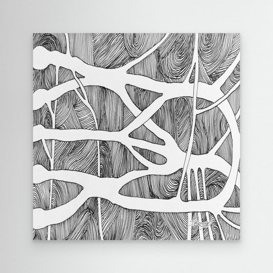 Brachial root plexus