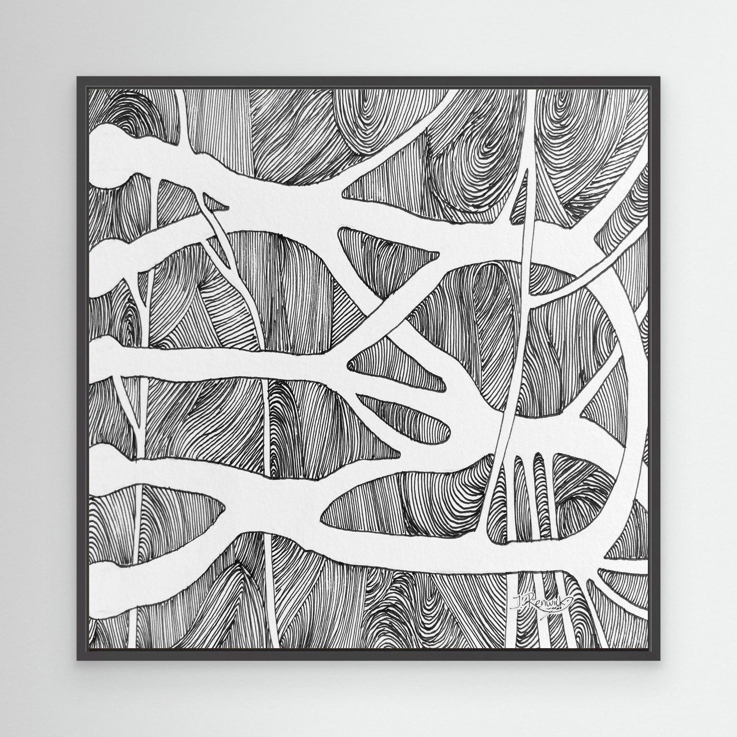 Brachial root plexus