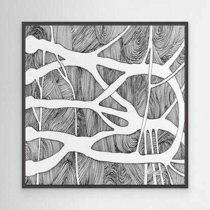 Brachial root plexus