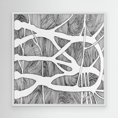 Brachial root plexus